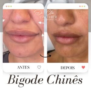 Snapinst.app_472571785_18288663652246917_293047596613591252_n_1080